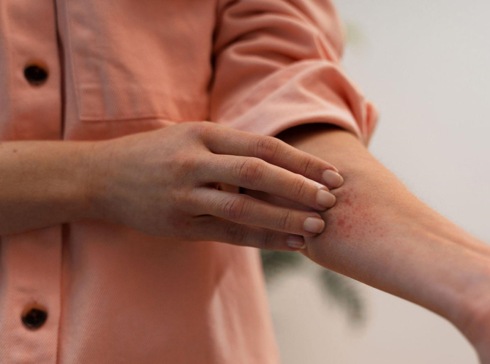 Día Mundial de la Dermatitis Atópica: JOHNSON'S® y DIM Centros de Salud destacan la importancia del cuidado temprano.